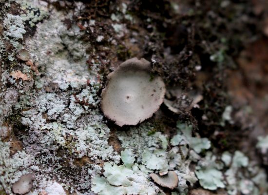 0VI.unbilical 3b 0VI.unbilical 3b